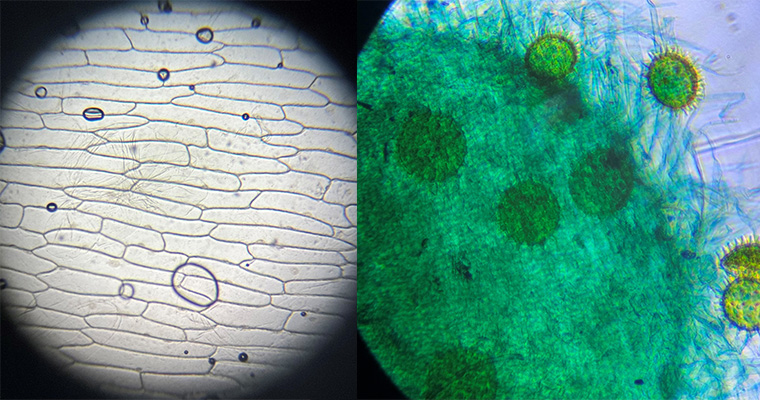 Lök och pollen under ett mikroskop. 